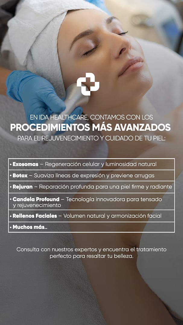 CarruselIDA05-02-2025